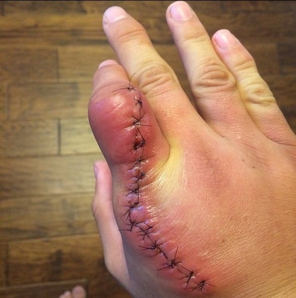 Gross Pic of the Day: Uncle Creepy’s Frankenstein Hand